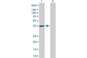 Western Blot analysis of AKR1C3 expression in transfected 293T cell line by AKR1C3 MaxPab polyclonal antibody. (AKR1C3 抗体  (AA 1-323))
