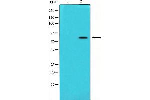 Western blot analysis of Angiopoietin 1 expression in HeLa cells,The lane on the left is treated with the antigen-specific peptide.