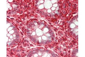 Human Colon: Formalin-Fixed, Paraffin-Embedded (FFPE). (ST3GAL4 抗体  (AA 171-220))