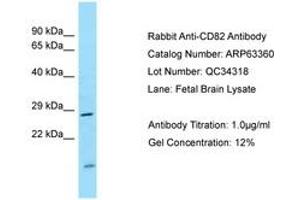 Image no. 1 for anti-CD82 (CD82) (AA 98-147) antibody (ABIN6749974) (CD82 抗体  (AA 98-147))