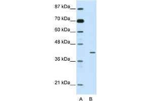 WB Suggested Anti-HMBOX1 Antibody Titration:  2. (HMBOX1 抗体  (N-Term))