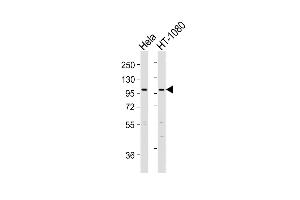 All lanes : Anti-ADTS6 Antibody (N-Term) at 1:2000 dilution Lane 1: Hela whole cell lysates Lane 2: HT-1080 whole cell lysates Lysates/proteins at 20 μg per lane. (ADAMTS6 抗体  (AA 118-151))