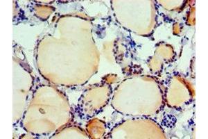 Immunohistochemistry of paraffin-embedded human thyroid tissue using ABIN7156617 at dilution of 1:100 (IRF2 抗体  (AA 120-349))