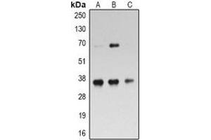Western blot analysis of RPL5 expression in Hela (A), Jurkat (B), MOLT4 (C) whole cell lysates. (RPL5 抗体)