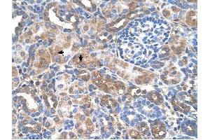GALNT6 antibody was used for immunohistochemistry at a concentration of 4-8 ug/ml to stain Epithelial cells of renal tubule (arrows) in Human Kidney. (GALNT6 抗体  (N-Term))