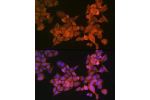 Immunofluorescence (IF) image for anti-Palladin, Cytoskeletal Associated Protein (PALLD) (AA 383-672) antibody (ABIN6145196)
