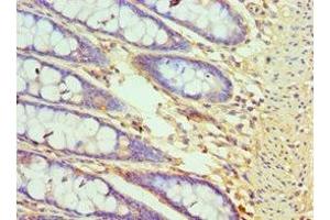 Immunohistochemistry of paraffin-embedded human colon tissue using ABIN7148781 at dilution of 1:100 (CXXC1 抗体  (AA 1-210))