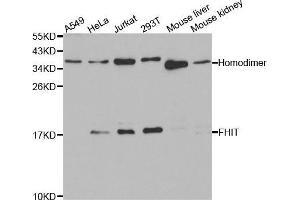 Western blot analysis of extracts of various cell lines, using FHIT antibody. (FHIT 抗体  (AA 25-147))