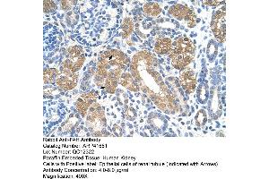 Immunohistochemistry (IHC) image for anti-Fumarylacetoacetate Hydrolase (Fumarylacetoacetase) (FAH) (C-Term) antibody (ABIN2776935)