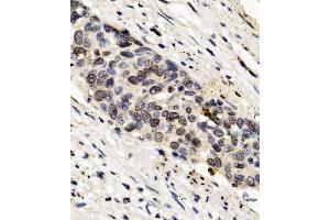 IHC analysis of FOXF1 using anti-FOXF1 antibody (ABIN7601744). (FOXF1 抗体  (AA 44-379))