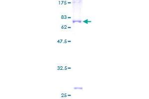 Image no. 1 for Interleukin 11 Receptor, alpha (IL11RA) (AA 1-422) protein (GST tag) (ABIN1307674)