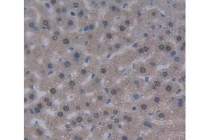IHC-P analysis of liver tissue, with DAB staining. (DKC1 抗体  (AA 298-509))
