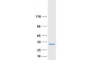 Western Blotting (WB) image for StAR-Related Lipid Transfer (START) Domain Containing 5 (STARD5) protein (Myc-DYKDDDDK Tag) (ABIN2732767)
