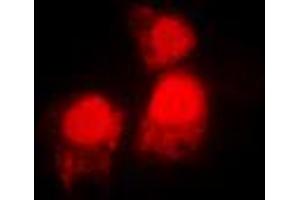 Immunofluorescent analysis of SIAH2 staining in MCF7 cells. (SIAH2 抗体  (C-Term))