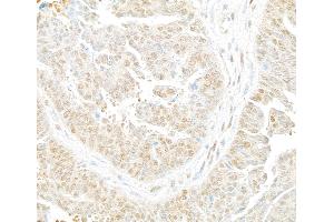 Immunohistochemistry (IHC) image for anti-HECT, UBA and WWE Domain Containing 1, E3 Ubiquitin Protein Ligase (HUWE1) (AA 2250-2300) antibody (ABIN7453584)