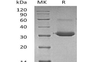 IgG1 Fc/IGHG1 protein (Fc Tag)