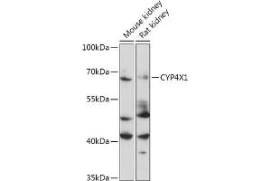 Western blot analysis of extracts of Mouse kidney, using CYP4X1 antibody (ABIN7266659) at 1:1000 dilution. (CYP4X1 抗体  (AA 190-290))