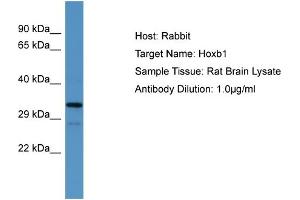 Host:  Rabbit  Target Name:  Hoxb1  Sample Type:  Rat Brain lysates  Antibody Dilution:  1. (HOXB1 抗体  (N-Term))