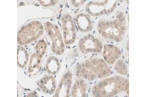 ABIN6266539 at 1/100 staining human kidney tissue sections by IHC-P. (FGFR2 抗体  (C-Term))