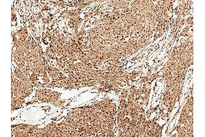 Immunohistochemistry analysis using Rabbit Anti-FUNDC1 Polyclonal Antibody (ABIN5066130). (FUNDC1 抗体  (N-Term) (Biotin))