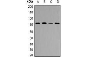 Western blot analysis of ZP2 expression in MCF7 (A), HeLa (B), RAW264. (ZP2 抗体)