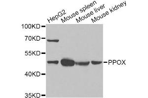 Western blot analysis of extracts of various cell lines, using PPOX Antibody (ABIN2564653) at 1:1000 dilution. (PPOX 抗体)