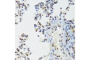 Immunohistochemistry of paraffin-embedded mouse lung using BAZ1B antibody (ABIN6003583) at dilution of 1/100 (40x lens). (BAZ1B 抗体)