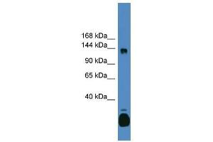 C10orf12 antibody used at 0. (Lcor 抗体  (C-Term))