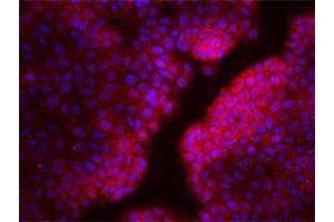 Immunofluorescence (IF) image for anti-Chemokine (C-X-C Motif) Receptor 4 (CXCR4) antibody (ABIN2664314) (CXCR4 抗体)