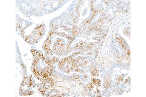 anti-Syndecan 1 (SDC1) (AA 23-251) antibody