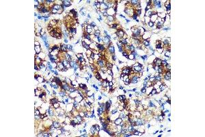 Immunohistochemistry (IHC) image for anti-Echinoderm Microtubule Associated Protein Like 4 (EML4) (AA 360-560) antibody (ABIN7266891)