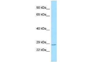 Host: Rabbit Target Name: Rnf13 Sample Type: Mouse Lung lysates Antibody Dilution: 1. (RNF13 抗体  (C-Term))