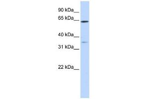 TRIM45 antibody used at 1 ug/ml to detect target protein. (TRIM45 抗体  (Middle Region))