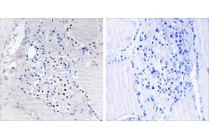 Peptide - +Immunohistochemistry analysis of paraffin-embedded human thyroid gland tissue using C9orf89 antibody. (C9orf89 抗体)