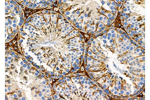 ABIN6254898 and ABIN6279150 at 1/100 staining Mouse testis tissue by IHC-P. (ATXN7L1 抗体  (N-Term))