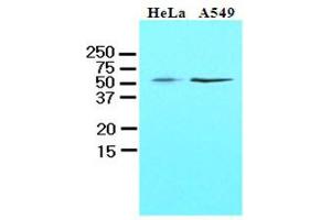 Western Blotting (WB) image for anti-Kruppel-Like Factor 4 (Gut) (KLF4) (AA 1-170), (N-Term) antibody (ABIN336104) (KLF4 抗体  (N-Term))