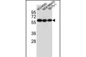 CHRNA10 Antibody (Center) (ABIN656120 and ABIN2845459) western blot analysis in NCI-,MDA-M,ZR-75-1 cell line lysates (35 μg/lane). (CHRNA10 抗体  (AA 179-206))