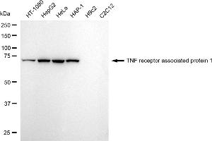 Western blotting analysis using TNF receptor associated protein 1 antibody (ABIN7800567). (Recombinant TRAP1 抗体)