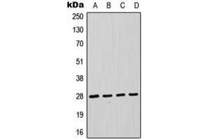 Western blot analysis of FADD expression in HeLa (A), Jurkat (B), THP1 (C), A431 (D) whole cell lysates. (FADD 抗体  (Center))