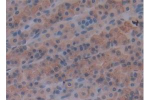 Detection of LAMA1 in Rat Stomach Tissue using Polyclonal Antibody to Laminin Alpha 1 (LAMA1)