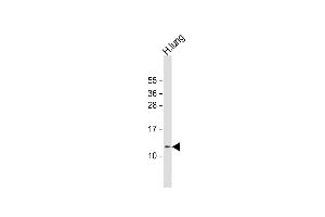 Anti-RIG Antibody (C-Term) at 1:1000 dilution + human lung lysate Lysates/proteins at 20 μg per lane. (DIRAS1 抗体  (AA 58-87))