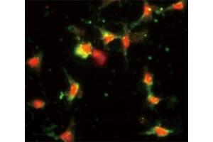 Immunofluorescence analysis of CCL2 antibody with HeLa cells.