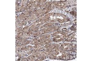 Immunohistochemical staining of human stomach with LRCH4 polyclonal antibody  shows moderate cytoplasmic and membranous positivity in glandular cells. (LRCH4 抗体)
