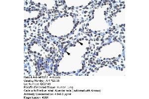 Human Lung (MYEF2 抗体  (Middle Region))