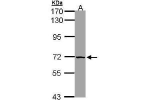 WB Image Sample (30 ug of whole cell lysate) A: 293T 7. (slc25a13 抗体)