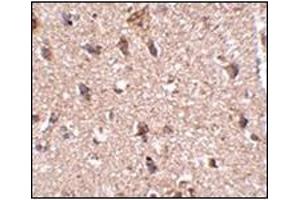 Immunohistochemistry of JPH3 in human brain tissue with this product at 2. (Junctophilin 3 抗体  (Center))