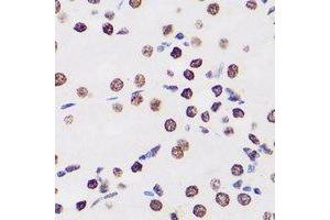 Immunohistochemical analysis of WDR5 staining in human kidney formalin fixed paraffin embedded tissue section. (WDR5 抗体)