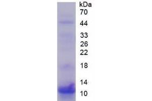 SDS-PAGE of Protein Standard from the Kit (Highly purified E. (S100P ELISA 试剂盒)