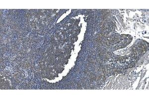 IHC analysis of eRF1/ETF1 using anti-eRF1/ETF1 antibody (ABIN7602625).