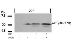 Image no. 2 for anti-V-Akt Murine Thymoma Viral Oncogene Homolog 1 (AKT1) (pSer473) antibody (ABIN196709) (AKT1 抗体  (pSer473))